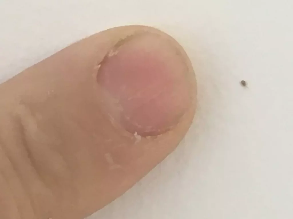 The size of a tiny Bird Mite next to a finger for reference.